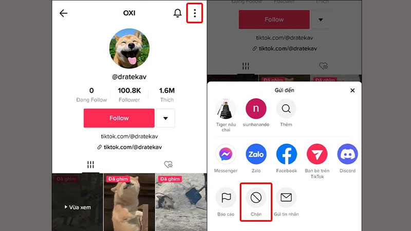 8-buoc-2-chon-tuy-chon-“chan” buoc chon tuy chon “chan”