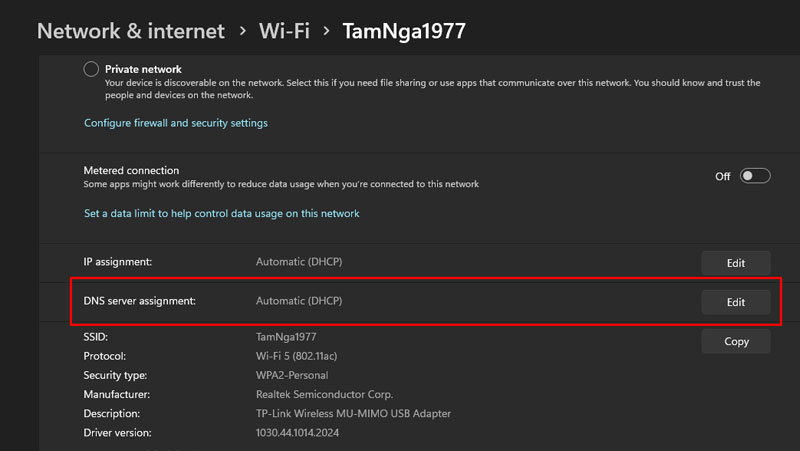 19-keo-xuong-nhan-edit-tai-muc-dns-server-assignment keo xuong nhan edit tai muc dns server assignment